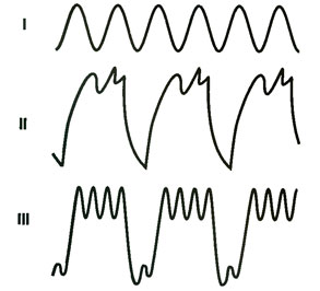 example of three curve variations